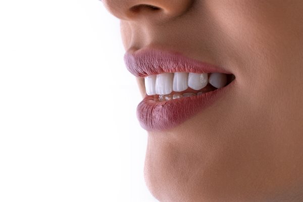 Invisalign — alinhadores transparentes para um sorriso discreto